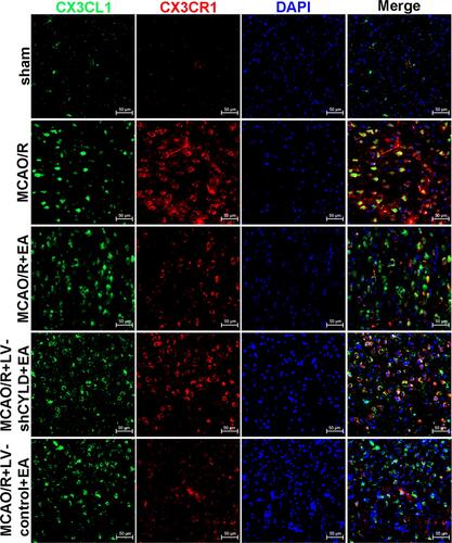 Figure 8 Co-expression of CX3CL1 (red) and CX3CR1 (green) in the periischemic cortex (n=5. Scale bar = 50 µm).