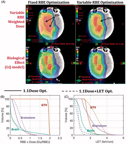 Figure 5. (A) Comparison of a glioblastoma IMPT plan optimized using criteria defined in terms of fixed RBE (RBE = 1.1) vs. the plan optimized using criteria defined in terms of variable RBE. The variable RBE was computed using the Wilkens and Oelfke model [Citation17]. The top two panels display dose distributions in terms of variable RBE-weighted dose whereas the bottom two panels display biological effect in terms of (1-surviving fraction) calculated using the linear-quadratic model. Panels (B) and (C) compare a pediatric brain tumor IMPT plan optimized based on criteria defined in terms of RBE 1.1-weighted dose vs. a plan based on the same criteria plus additional terms that control LET in the target and normal structures. Panel (B) compares the RBE 1.1-weighted DVHs for the GTV, brainstem and normal brain, whereas panel (C) compares the corresponding LET-volume histograms. This figure demonstrates that significant increases in LET values in the tumor and significant reduction in normal structures is possible. Of course, the achievable biological effect gain depends on the geometric configuration of anatomic structures and may necessitate tradeoffs. (W. Cao, MD Anderson Cancer Center, unpublished.).