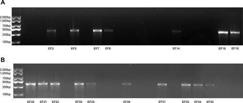 Figure 1 (A) electrophoresis-analysis-of-optra-resistance-gene-in-40-LNSE-strains. (B) electrophoresis-analysis-of-optra-resistance-gene-in-40-LNSE-strains.