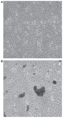 Figure 7 Optical microscopic images of cells cultured in the presence of control samples (sample (A) containing the powder (B)).