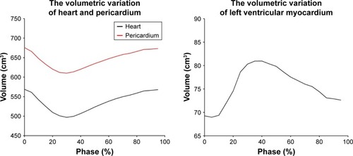 Figure 3 Volumetric variation of the heart, pericardium, and LVM.