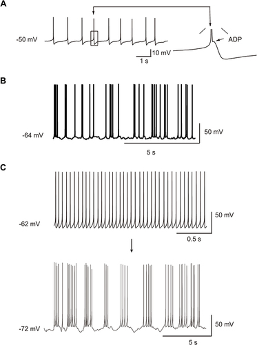 Figure 2 Spontaneous firing of DRG neurons. (A) Spontaneous ADP firing. The arrow indicates a single, enlarged ADP. ADP: after-depolarizing potential. (B) Spontaneous burst firing. (C) Spontaneous tonic firing turned to a spontaneous burst firing after a slight hyperpolarization.