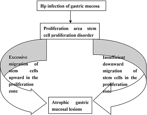 Figure 1 A flow chart: occurrence and development of mucosal atrophy caused by Hp infection in gastric mucosa.