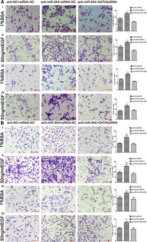 Figure 5 Cell invasion and migration in rescue experiment. GATA6 knockdown reversed cell migration and invasion functions caused by the silencing miR‐944 with or without EGF (50 ng/mL) treatment. (A) Cell migration and invasion assays in Human colon cancer cells‐116 (HCT116) cells, and (B) Cell migration and invasion assays in SW480 cells, n = 3, *P < 0.05 and **P < 0.01 using t-test.