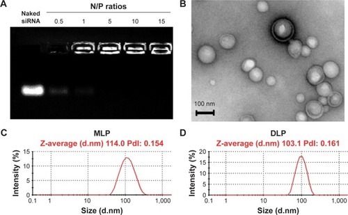 Figure 2 Gel retardation and spectrometer assay for MLP/siRNA complexes.Notes: (A) Gel retardation assay of complexation efficiency of siRNA at various N/P ratios. (B) Transmission electron microscopic image of MLP/siRNA complexes. (C) The DLS size distribution by intensity of MLP. (D) The DLS size distribution by intensity of DLP.Abbreviations: DLP, Bis(palmitoyloxy)-3-(dimethylamino)propane liposomes; DLS, dynamic light scatter; MLP, O′1,O1-(3-(dimethylamino)propane-1,2-diyl) 16-bis(2-(2-methyl-5-nitro-1H-imidazol-1-yl)ethyl) di(hexadecanedioate) liposomes; siRNA, small interference RNA; N/P nitrogen/phosphate.