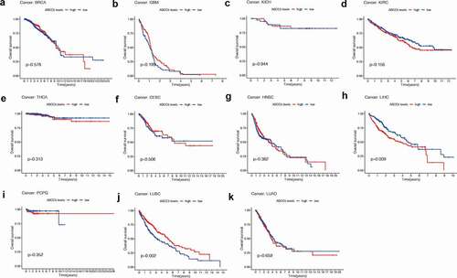 Figure 2. The prognostic value of ABCC5 in pan-cancer. (a)High ABCC expression has no prognostic value in BRCA (p = 0.578). (b)High ABCC expression has no prognostic value in GBM (p = 0.199). (c)High ABCC expression has no prognostic value in KICH (p = 0.944). (d)High ABCC expression has no prognostic value in KIRC (p = 0.156). (e)High ABCC expression has no prognostic value in THCA (p = 0.313). (f)High ABCC expression has no prognostic value in CESC (p = 0.506). (g)High ABCC expression has no prognostic value in HNSC (p = 0.382). (h)High ABCC expression is associated with poor prognosis of LIHC (p = 0.009). (i)High ABCC expression has no prognostic value in PCPG (p = 0.352). (j)High ABCC expression is associated with poor prognosis of LUSC (p = 0.009). (k)High ABCC expression has no prognostic value in LUAD (p = 0.659)