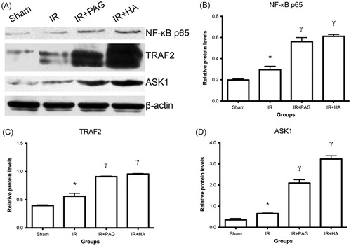 Figure 2. Increase of nuclear NF-κB p65, phosphorylated ASK1 and phosphorylated TRAF2 in kidney after IRI. (A) Western blot analysis of NF-κB p65, phosphorylated-ASK1 and TRAF2 in kidney after IRI. β-Actin served as internal control for semi-quantification of NF-κB p65, phosphorylated-ASK1 and TRAF2. Relative protein levels of NF-κB p65 (B), phosphorylated-TRAF2 (C) and ASK1 (D) were compared among different groups. Notes: Data shown are mean ± SEM; *statistically significant from sham group (p < 0.05); γstatistically significant from IR group (p < 0.01); n = 3 each.