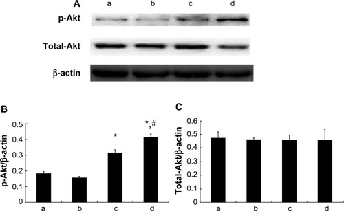 Figure 7 Myocardial total-Akt and p-Akt expression. (A) p-Akt and total-Akt protein expressions detected by Western blotting; (B) Relative protein expression level of p-Akt; (C) Relative protein expression level of total-Akt; (a) control group; (b) 1 μM picroside II pretreatment group; (c) 10 μM picroside II pretreatment group; and (d) 100 μM picroside II pretreatment group.