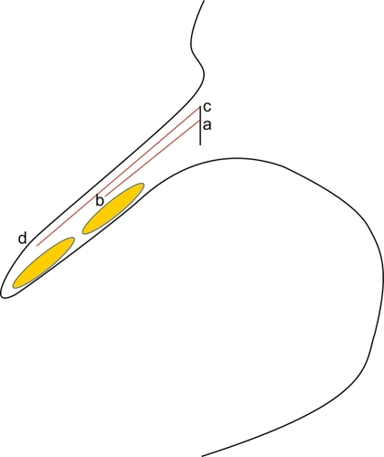 Figure 4 Showing ab × gold plate weight is less than cd × same gold plate weight.