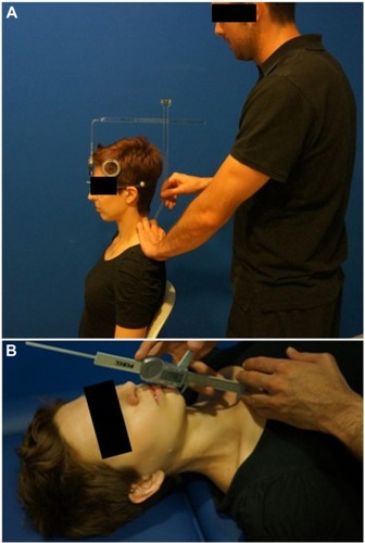 Figure 2 Craniocervical posture measurements.