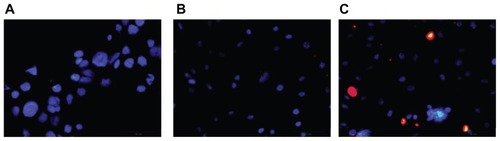 Figure 6 Fluorescence microscopic images of endocytosis of bEND3 cells after 2 hours of incubation of (A) the blank control, (B) free quantum dots in an aqueous solution, and (C) theranostic liposomes with quantum dots. Cell nuclei are observed with blue staining by 4′,6′-diamidino-2-phenylindole.Note: The red signals represent the quantum dots accumulation.