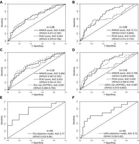 Figure 2 PCa and csPCa detection in the prebiopsy cohort. The number of patients is indicated by n. (A) ROC curves for PCa detection by AMACR score and PCA3 score (whole prebiopsy cohort), (B) ROC curves for csPCa detection by AMACR score and PCA3 score (whole prebiopsy cohort), (C) ROC curves for PCa detection by AMACR score, PCA3 score and PCPTRC, (D) ROC curves for csPCa detection by AMACR score, PCA3 score and PCPTRC, (E) ROC curve for PCa detection by classification model, (F) ROC curve for csPCa detection by classification model.