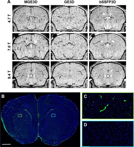 Figure 2 (A) Representative in vivo images of mice 13 h post-VCAM-USPIO injection at different magnetic fields. Three sequences of MGE3D, GE3D, and bSSFP3D are shown from a 3D dataset. Hypointensities were detected in both hemispheres of the brains. (B–D) Histological assessment of VCAM upregulation at the injection side.Notes: Green vessels show unilateral upregulation of VCAM, nuclei are shown in blue. Scale bar: 1 mm.Abbreviations: bSSFP3D, balanced steady-state free precession 3D; GE3D, gradient echo 3D; MGE3D, multi-gradient echo 3D; USPIO, ultra-small superparamagnetic iron oxide; VCAM, vascular cell adhesion molecule.