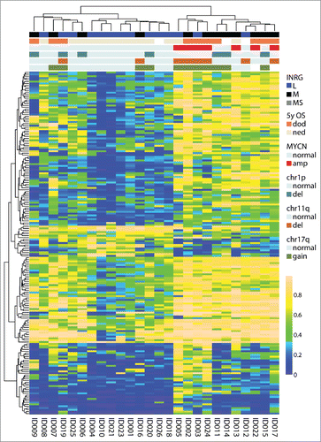 Figure 5. Validation of the INRG separation from the 450K results with 27K data. 187 probes from the intersect that were on both the 450K and the 27K platform separated the samples on cluster 1 and cluster 2 (both on INRG and survival, 2-sided Fisher exact probability test P=0.045 and P=0.013, respectively). OS, overall survival; dod, dead of disease; ned, no evidence of disease; amp, amplified; del, deletion.