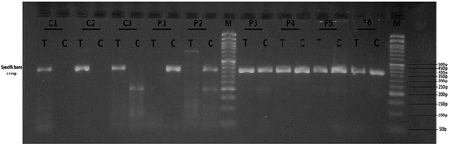 Figure 5. Gel electrophoresis (2%) for PCR product of SOD2 rs4880. Lane M indicates DNA marker (50 bp). Specific 356 bp band illustrates T or C allele. Lanes (C1, C2 and C3) represent TT homozygous genotyping where C allele absents in control group. Lanes (P1, P2) represent CC homozygous genotyping where C allele appears at lanes P1 and P2 at 356 bp in cases group while lanes (P3, P4, P5 and P6) represent TC heterozygous genotyping where T and C alleles appear at 356 bp in cases group.