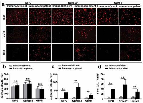 Figure 4. Inflammation infiltration in DIPG, GBM1, and GBM551 tumors in immunocompetent mice. (a) Xenografts in immunocompetent mice engaged an innate and adaptive immune cell surveillance, as revealed by microglia (Iba1), leukocyte (CD45), and T-cell (CD3) infiltration. Immunodeficient mice showed only microglial activation. The scale bar is 50 μm. (b) Quantification of histological assessments for Iba1 immunostaining showed microglial activation in both immunocompetent and immunodeficient mice. Quantification of CD45 (c) and CD3 (d) immunostaining showed leukocyte and T-cell infiltration only in immunocompetent mice. N = 9 slices from three animals/group. Mean ± SD, *p < 0.05, **p < 0.01, n.s. is no significant difference, independent t-test.