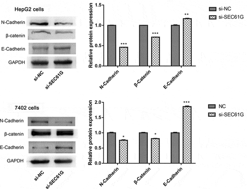 Figure 7. The expression of proteins involved in cell migration and invasion in HepG2 and 7402 cells after transfection with si-SEC61G or si-NC. The experiments were carried out for three times. Data are expressed as mean ± SD. * P < 0.05, ** P < 0.01, and *** P < 0.001 compared with si-NC group. 27 Oct