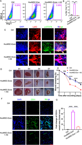 Figure 8 HucMSC-Exo facilitates angiogenesis and wound closure by inducing neutrophils skewing toward N2 phenotype in diabetic wounds. (A) Flow cytometry analyzed the proportion of N2 phenotype neutrophils (Ly-6G+Arg1+) in diabetic wounds treated with HucMSC-Exo or HucMSC-Exo plus AS1517499. (B) Quantitative analysis of the results in (A) (n=3). (C) Representative immunofluorescence images of Ly6G+pSTAT6+ neutrophils in wound treated with HucMSC-Exo or HucMSC-Exo plus AS1517499. Scale bars, 50 μm. (D) The gross view of wounds from mouse treated with HucMSC-Exo or HucMSC-Exo plus AS1517499. (E) Quantification of the wound closure. (F) In vivo distribution of CD31 labeled neovessels in wound treated with HucMSC-Exo or HucMSC-Exo plus AS1517499. Scale bars, 100 μm. (G) Quantification of fold change of CD31+ vessel area (% total area). [****p < 0.0001; data were expressed as mean ± SD and analyzed by unpaired two-tailed t-test].