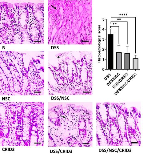 Figure 1 Histopathological examination. Photomicrographs of colon sections from: (N), (NSC), and (CRID3) display normal mucosa and crypts; (DSS), shows diffuse mucosal necrosis and damaged crypts (open arrow); (DSS/NSC), shows superficial necrosis of surface epithelium (filled arrowhead); (DSS/CRID3), shows mucosal edema with few inflammatory cell infiltration (filled arrow); (DSS/NSC/CRID3), displays improved histology and retained normal appearance. As shown in histological score, the DSS gp has the highest score. Additionally, the DSS/NSC/CRID3 gp show marked decrease in the score compared with that of the DSS gp. H&E stain, X 400, bar = 50 µm. **P < 0.01 vs DSS, ***P < 0.0001 vs DSS.