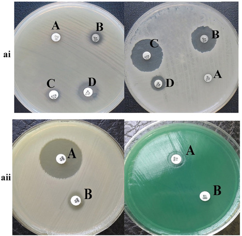 Figure 1 ai: The result of phenotypic detection of ESBL-producing Pseudomonas aeruginosa by Double-Disk Confirmatory Test (DDCT) in Pseudomonas aeruginosa. A: Ceftazidime (30 µg); B: ceftazidime + clavulanate (30/10µg); C: cefotaxime + clavulanate (30/10µg); D: cefotaxime (30 µg). Top: ESBL negative strain; Bottom: ESBL positive strain; ESBL positive isolates show an increase of 5 mm zone of inhibition with clavulanic acid as compared to the zone size for CTX and CZD alone. aii: The result of phenotypic detection of MBL-producing Pseudomonas aeruginosa by EDTA-imipenem microbiological (EIM) test in Pseudomonas aeruginosa. A: EDTA + imipenem; B: imipenem. Top: MBL positive strain; Bottom: MBL negative strain; MBL considered positive when zone diameter difference between imipenem + EDTA and imipenem discs was larger than 7 mm.