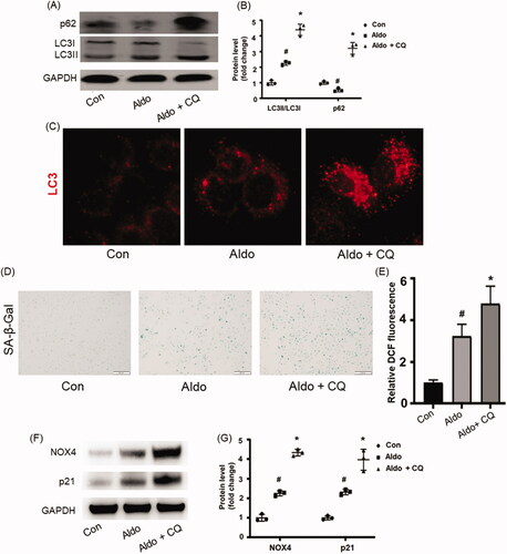 Figure 2. Blocking autophagy worsened Aldo-induced OS and senescence in HK-2 cells. (A) Western blot analysis revealed the expression of LC3-II/LC3-I, p62, and GAPDH proteins in HK-2 cells after various treatments as indicated (n = 3). (B) The graphical presentation indicates the relative abundance levels of LC3-II/LC3-I and p62 after normalization with GAPDH (n = 3). (C) Immunofluorescence staining for LC3 in HK-2 cells, which were incubated in media containing buffer (Control), Aldo, or Aldo + CQ for 24 h as indicated (n = 3). (D) SA-β-gal activity, which appears as a bright-blue granular staining in the cytoplasm of HK-2 cells in various groups as indicated (n = 3). (E) Quantification of 2’, 7’-dichlo-rofluorescein (DCF) fluorescence in various groups as indicated (n = 3). (F) Western blot analysis showed the expression of p21 and GAPDH proteins in HK-2 cells after various treatments as indicated (n = 3). (G) Graphical presentation shows the relative abundance levels of p21 and NOX4 after normalization with GAPDH (n = 3). #p < 0.05 vs. normal control, *p < 0.05 vs. Aldo alone.