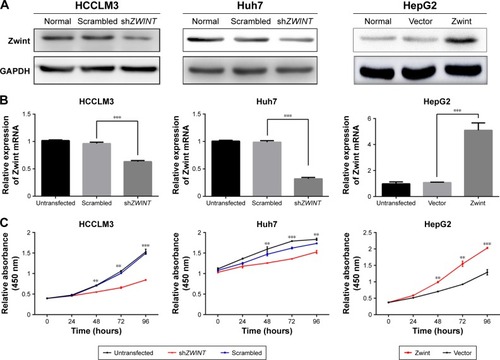 Figure 5 Effect of Zwint on proliferation of HCC cells.