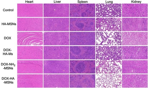 Figure 9 Histological images from the major organs of mice in the different groups of 4T1 tumor-bearing mice on day 22 (n=6). Tissues were collected from the brain, heart, liver, spleen, lung and kidney. Images were taken at ×20 magnification with standard hematoxylin and eosin (HE) staining.