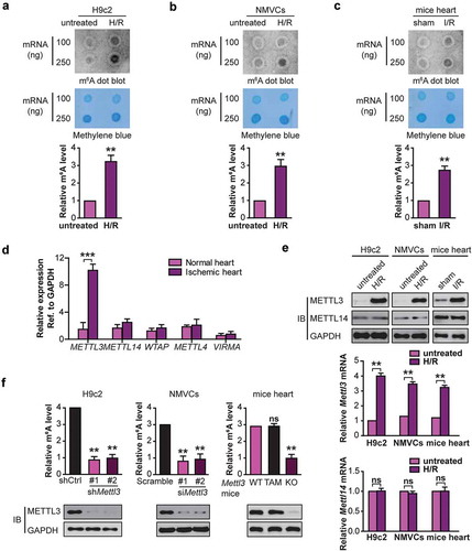 Figure 1. H/R and I/R induces elevated levels of m6A RNA modification in cardiomyocytes and mice heart respectively. RNA dot blot analysis (upper panel) of m6A levels in H/R-treated H9c2 cells (a), NMVCs (b), and focal I/R-treated mice heart tissues (c). Methylene blue staining served as a loading control (middle panel). And quantification of RNA dots are shown (lower panel). (mean ± SD; n = 3; **P < 0.01 vs. untreated/sham). (d) The levels of m6A modification–associated genes in 10 pairs of heart tissues from infarct patients and normal heart tissues (mean ± SD; n = 10; ***P < 0.001 vs. normal heart). (e) The mRNA and protein levels of METTL3 and METTL14 in H/R-treated H9c2 cells, NMVCs, and focal I/R-treated mice heart tissues (mean ± SD; n = 6; **P < 0.01 and ns: no significant difference vs. untreated/sham). (f) H9c2 cells and NMVCs with or without METTL3 knockdown were exposed to H/R, or WT and mice lacking cardiac METTL3 (Mettl3-KO) (WT: Mettl3flox/flox MerCreMer+/+ treated with oil; TAM: Mettl3+/+ MerCreMer+/+ treated with tamoxifen; KO: Mettl3flox/flox MerCreMer+/+ treated with tamoxifen) were exposed to focal I/R. Total RNA was extracted, and m6A content was determined (mean ± SEM; n = 6; **P < 0.01 vs. shCtrl/Sramble/WT Mettl3 mice). All above the heart tissue samples were collected from the injured region of I/R-treated mice. P values were calculated with student’s t-test.