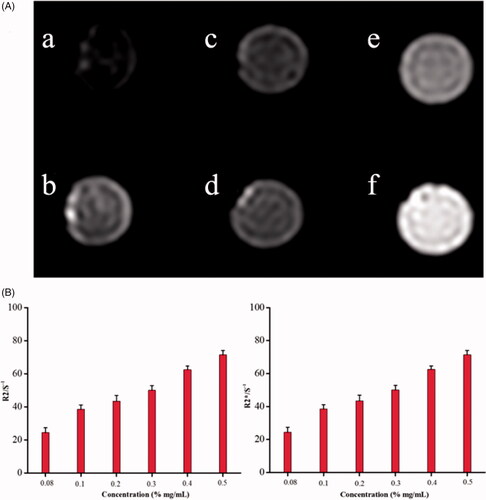 Figure 4. (A) MRI image of different concentrations of Fe3O4 nanoparticles. (B) R2 and R2* relaxometry rates of different concentrations of Fe3O4 nanoparticles.