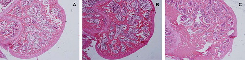 Figure 8. Observation of trabecular structure by HE staining showed that the trabecular structure in the sham group was longitudinally arranged and interlaced into a mesh-like pattern (C); compared with the sham group the trabeculae in the OVX group (A) were thinner, more sparse, the number was significantly reduced and blind sides increased, and the normal reticular structure disappeared. Compared with the OVX group, the trabeculae of the RANK group (B) were thicker, more closely arranged, and substantially maintained the normal reticular structure.