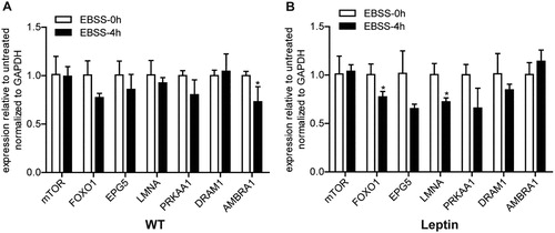 Figure 3. Effect of leptin on the mRNA expression levels of autophagy signaling pathway-related genes in PFCs. Both types of cells were treated with EBSS for 0 and 4 h. (A, B) The mRNA expression levels of the autophagy signaling pathway-related genes mTOR, FOXO1, EPG5, LMNA, PRKAA1, DRAM1 and AMBRA in both treated cells. *p < 0.05 compared to the EBSS treatment at 0 h in both PFCs.