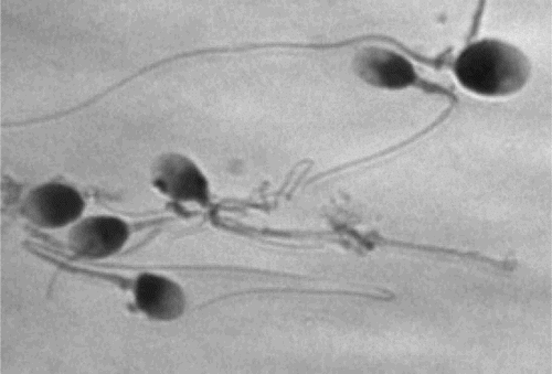 Figure 1.  Spermatozoa after Papanicolaou staining.