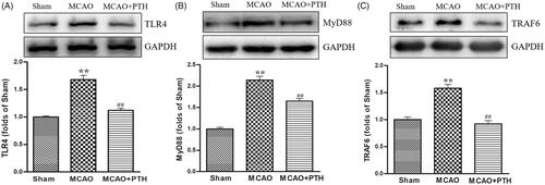 Figure 5. Effects of PTH on TLR4 (A), MyD88 (B), and TRAF6 (C) protein expression in MCAO rats (n = 3). Data are presented as mean ± SEM. *p < 0.05, **p < 0.01 vs. Sham; #p < 0.05, ##p < 0.01 vs. MCAO.