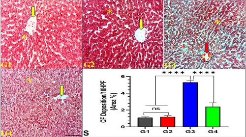 Figure 2 Effect of garlic extract on trastuzumab induced CF deposition in the liver tissues. Liver tissues from G1 and G2 show typical hepatic architecture of hepatocytes (yellow star) with normal central vein (yellow arrow) and minimal CF deposition, whereas G3 reveals hydropic changes of hepatocytes (yellow star) with marked CF deposition (red star) and congested central veins (red arrow). In contrast, G4 exhibits normal features of hepatic architecture, nearly similar to G1. Masson’s trichrome stain, 200x, bar =100 µm. (S) Quantitative analysis of CF deposition area %/10 HPF. nsNo significance between G1 vs G2, ****Significance difference G1, G2 vs G3, and G3 vs G4 (p<0.001).
