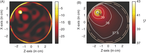 Figure 15. Power and temperature distribution of hyperthermia of a 6 mm tumour centred at (1.5, −1.5): (A) Power deposition, and (B) Temperature distribution.
