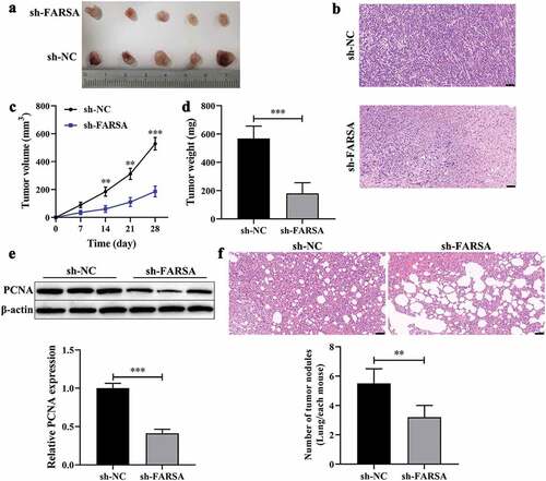 Figure 3. Knockdown of circFARSA inhibited tumor growth and metastasis in vivo. BALB/c nude mice have subcutaneously injected with NCI-1299 (1 × 106) cells with stably low-expressing circFARSA (sh-FARSA) or sh‑NC. (a), Tumors were dissected and imaged. (b), Histology examination of tumor slices by hematoxylin and eosin (H&E) staining, Scale bar = 50 μm. (c), Tumor volume was measured every seven days. (d), After 28 days of inoculation, the tumor weight of each group was examined. (e), Western blot was performed to detect the protein levels of PCNA in tumor tissues of xenograft BALB/c nude mice. (f), BALB/c nude mice were injected with NCI-H1299 cells with or without sh-FARSA using the tail vein containing 5 × 105 cells in 0.1 mL PBS. Lung tissues were analyzed by H&E staining, Scale bar = 50 μm. **P < 0.01, ***P < 0.001, Compared with the sh-NC group.