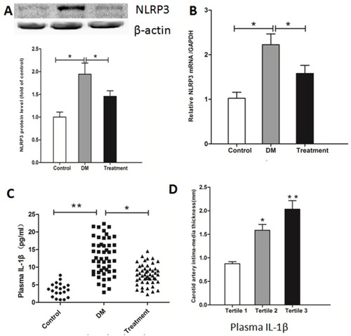 Figure 1 Comparison of NLRP3 expression and plasma IL-1β level in healthy controls and diabetic patients. PBMCs were isolated, and NLRP3 protein level (A) and mRNA level (B) were determined by Western blotting and real-time PCR. Plasma IL-1β was assayed with ELISA (C). Carotid atherosclerosis of diabetic patients was evaluated by standard B-mode ultrasound (D). Data represent mean ± SD. *P<0.05, **P<0.01 vs controls and treatment or vs tertile 1.