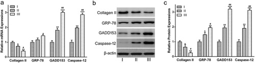 Figure 2. The expression of Collagen II, GRP78, GADD153 and Caspase-12 in cartilages from patients with different OA grades. (a) mRNA and (b) protein expressions of Collagen II and ER stress markers were determined via qRT-PCR analysis and Western blot analysis, respectively. (c) was the statistical analysis of (b). Data were presented as mean ± SEM. Experiments were repeated in triplicate. *p < 0.05, **p < 0.01 and ***p < 0.001 compared to grade I. #p < 0.05 and ##p < 0.01compared to grade II.
