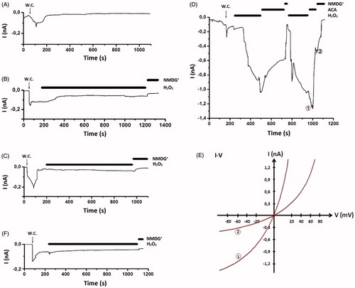 Figure 1. Effects of curcumin on TRPM2 channel activity in SH-SY5Y neuroblastoma cells. (A) Control record: original recordings from SH-SY5Y cells. (B) Non-transfected control group, was tested whether H2O2 cause on the cellular cationic currents or not. (C) Non-transfected but curcumin incubated records of cells were to test any relationship between curcumin incubation and H2O2 induction on the currents. (D) TRPM2 currents in the transfected SH-SY5Y cells were stimulated by H2O2 (10 mM) in the chamber (bath) solution and they were inhibited by ACA (25 μM) in the bath. (E) I–V curve of panel D: current-voltage relationships of whole-cell currents in the presence of various extracellular cations, activators and inhibitors as indicated (same experiments as in panel D). (F) TRPM2 currents inhibited by curcumin incubation in the transfected + curcumin group. The cells were incubated with curcumin (5 μM) after transfection for 24 h and then they were not gated by H2O2 administration (in the patch chamber). The holding potential was -60 mV. NMDG+ time is shown where the normal bath solution (140 nM Na+) was exchanged to a solution with NMDG+ as main cation (150 mM, Ca2+ free solution). W.C.: Whole cell.