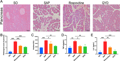 Figure 4 QYD or CDK5 inhibitors ameliorated inflammation and pancreatic injury in SAP rats. (A) Hematoxylin and eosin (HE) staining was analyzed for pathological changes in pancreatic tissues (scale bar, 100 μm). (B) Histopathological scores of pancreatic tissues in each group. (C) Analysis of serum amylase levels. (D and E) Analysis of serum levels of inflammatory factors TNF-α and IL-6 in each group of rats. Data are representative images or expressed as mean ± SD from at least three independent experiments in each group of rats; *P < 0.05, **P < 0.01, ***P < 0.001.