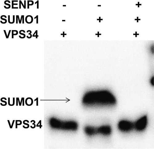 Figure 4. Immunoprecipitation analysis of the effect of SENP1 on SUMOylation of VPS34 by SUMO1. One band was observed for HUVECs treated with only VPS34, but two bands were observed for HUVECs co-transfected with VPS34 and SUMO1 overexpressing plasmids. Moreover, only one band was observed for HUVECs co-transfected with VPS34, SUMO1 and SENP1 overexpressing plasmids, and the molecular weight of this band was also reduced.