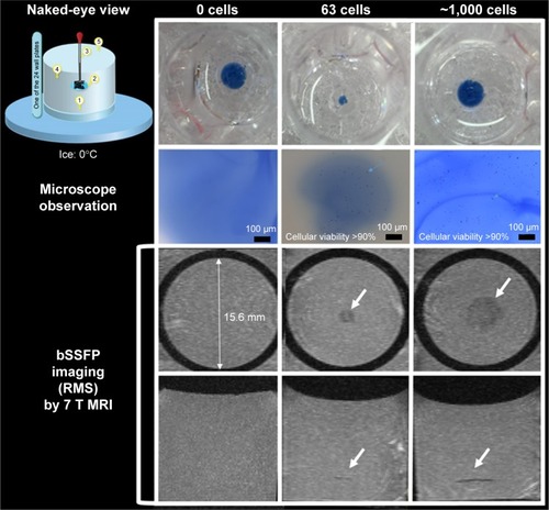 Figure 3 Diagram showing phantom preparation method by fixing macrophages between two layers of gelatin without air bubbles.Notes: Numbers in naked-eye view image indicate as (1) adding 200 μL 4% gelatin at the bottom of each well; (2) adding 100 μL 4% gelatin in the middle of each well and on top of the solid layer formed by the 200 μL gelatin of step 1; (3) injecting 10 μL media with labeled cells and 10% trypan blue in the middle of the previously added 100 μL 4% gelatin before it was frozen; (4) filling the tube with 4% gelatin after the gelatin turned solid and the cells were fixed; (5) removing air bubbles in gelatin using a pipette. Both microscope (top row, dark dots are individual cells) and MRI (second and third rows showing sagittal and axial views of RMS combined bSSFP images) can be used to image the phantom. A cellular level of, 100 cells can be achieved with this phantom and can be clearly detected by MRI with RMS combined phase-cycled bSSFP images. White arrows show the location of the labeled cells.Abbreviations: bSSFP, balanced steady-state free precession; MRI, magnetic resonance imaging; RMS, root mean square.