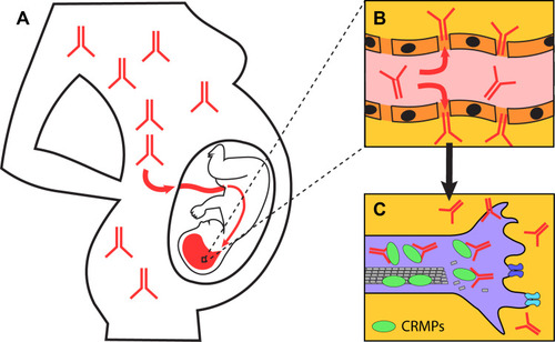 Figure 1 Model of targeting of CRMPs by maternal autoantibodies in MAR ASD. (A) Maternal autoantibodies targeting CRMPs readily pass placenta and (B) the undeveloped blood-brain barrier of the fetus. (C) The antibodies are internalized into neurons, bind and inactivate CRMPs resulting in changes in neural development.