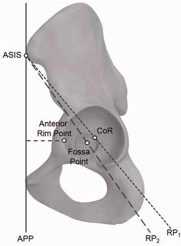 Figure 2. Alternative reference planes RP1 (ASIS-ASIS-CoR) and RP2 (ASIS-ASIS-Fossa) to define the sagittal orientation of the pelvis. The distance between the anterior rim point and the APP is also shown: This distance was used to define RP3.