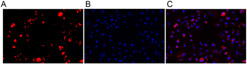 Figure 6 miR-10a-HUMSCs-Exosomes can be internalized into OGCs. (A) Red staining indicated PKH26-labeled miR-10a HUMSCs-exosomes. (B) Blue stains indicated DAPI-labeled nuclei. (C) Merged image of HUMSCs-exosomes uptake of miR-10a by GCs.