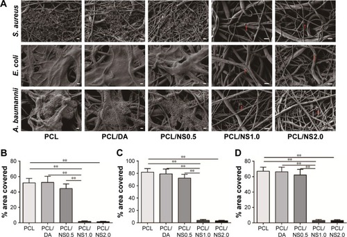 Figure 6 The effect of PCL/NS on the formation of biofilms.Notes: (A) SEM morphology of biofilms on the surfaces of PCL, PCL/DA, PCL/NS0.5, PCL/NS1.0 and PCL/NS2.0; the red arrows indicate the adherent bacteria. The quantitative area covered by the biofilms of (B) S. aureus, (C) E. coli and (D) A. baumannii. Scale bars: 1 µm. Magnification of images in PCL, PCL/DA and PCL/NS0.5 groups are ×3,000, and the magnification of images in PCL/NS1.0 and PCL/NS2.0 groups are ×5,000. **p<0.01.Abbreviations: A. baumannii, Acinetobacter baumannii; DA, dopamine; E. coli, Escherichia coli; NS, nanosilver; PCL, polycaprolactone; S. aureus, Staphylococcus aureus; SEM, scanning electron microscopy.