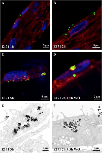 Figure 3. Absorption kinetics of buccal TR146 cells exposed to food-grade TiO2 (E171) particles. (A-D) Confocal images of TR146 cell sections treated with 50 µg/ml E171 for 1 h, 2 h and 5 h, or 2 h plus a wash-out (WO) of 5 h. The laser-reflecting (metal) particles appear green, the WGA-labelled glycoproteins appear red, and cell nuclei appear blue. (E-F) TEM images of TR146 cell sections treated with 50 µg/ml E171 for 5 h (E) and 2 h followed by a 5 h wash-out (F).