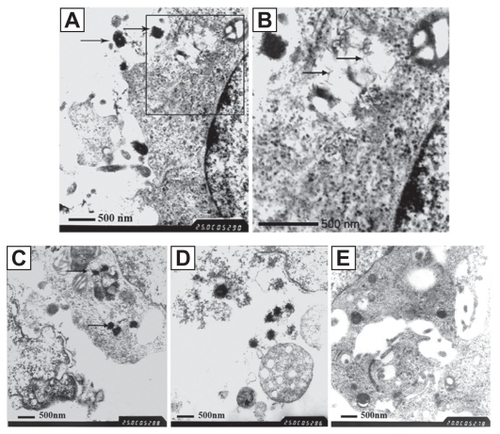 Figure 2 TEM images on the ultrastructure of the affected cells. A) The CNPs, diameter of 200–400 nm, with needle-like crystals, stuck to the outer membranes of the cells. B) The enlarged scale of Figure 2A, showing the vacuolus containing mineralization crystals and swollen mitochondrion (TEM × 25,000). C) Some particles located in the cytolysosome, phagocytosed by the HDPCs. The affected cells show swollen mitochondria and a disordered arrangement of the mitochondrial lamellar body. D) Cells surrounded by CNPs, showing necrosis and disintegration. Released vacuolized mitochondria can be seen (TEM × 25,000). E) The negative control, showing the normal ultrastructure of the cells (TEM × 20,000).Abbreviations: CNPs, calcifying nanoparticles; HDPC, human dental pulp cell; TEM, transmission electron microscopy.
