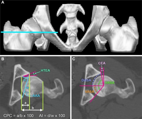 Figure 4 Measurements and three-dimensional models for evaluating the dysplastic canine hip.