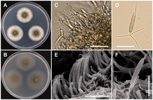 Figure 5. Morphology of B. robillardoides CNUFC-CNUP1-1. (A), Colonies in potato dextrose agar (PDA). (B), Colonies in malt extract agar (MEA). (C,E), Conidiogenous cells with developing conidia. (D,F), Conidia. (C, D: observed under light microscope; E, F: observed under SEM) (scale bars C, D = 20 µm; E = 15 µm, F = 10 µm).